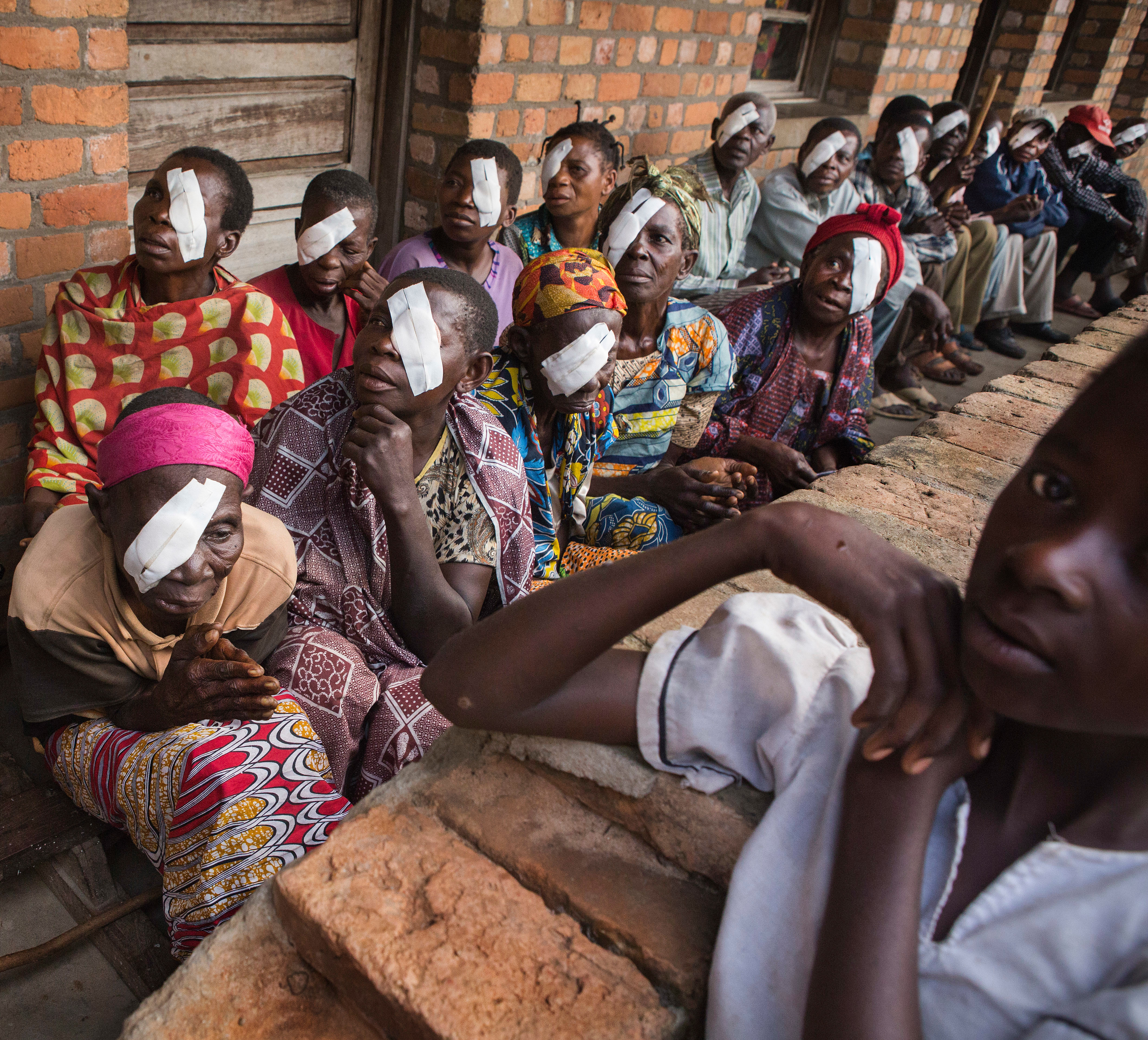 Patients portant un pansement oculaire dans une clinique africaine