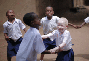 Afrikaanse ondervoede kinderen die samen spelen