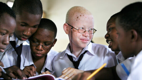 Albino child Tanzania